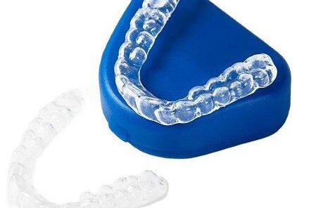 Детские элайнеры Flexiligner под ключ на две челюсти
