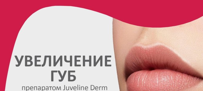 Увеличение губ препаратом Juveline Derm - 6520 вместо 16720