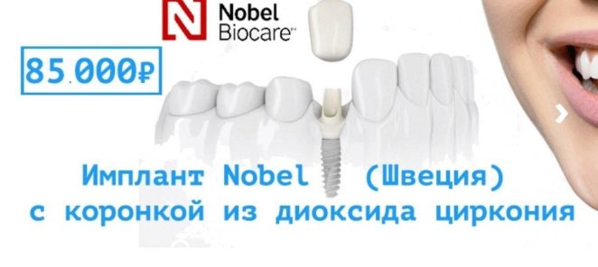 Имплант Nobel Biocare - 85000 рублей!