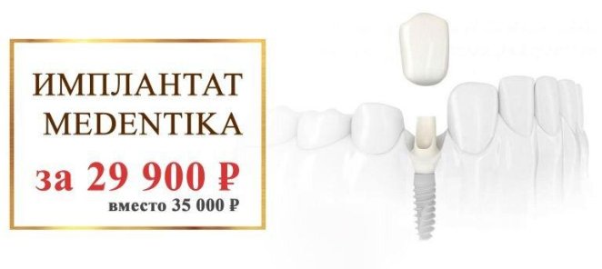 Имплантат Medentika за 29 900 рублей