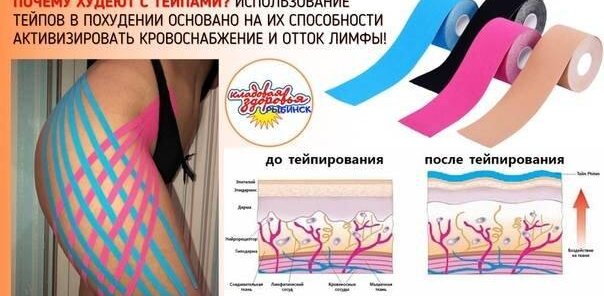 Худей вместе с тейпирование по спец цене 500 руб!!!