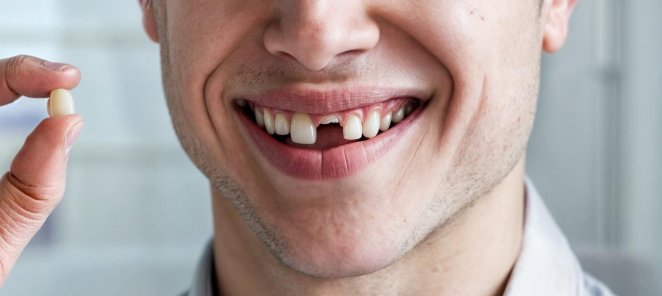 Восстановление утраченного зуба (имплант+коронка) за 60000р.