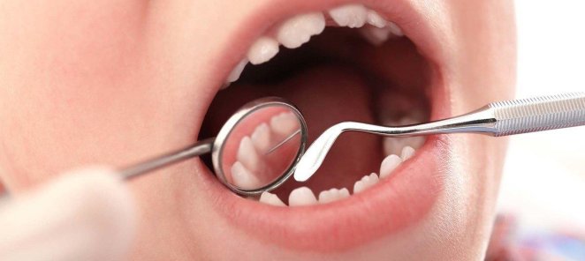 Лечение кариеса на молочном зубе -5000 руб
