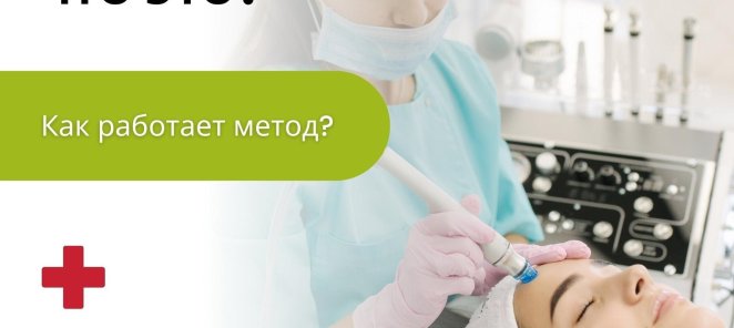 Процедура Фраксель