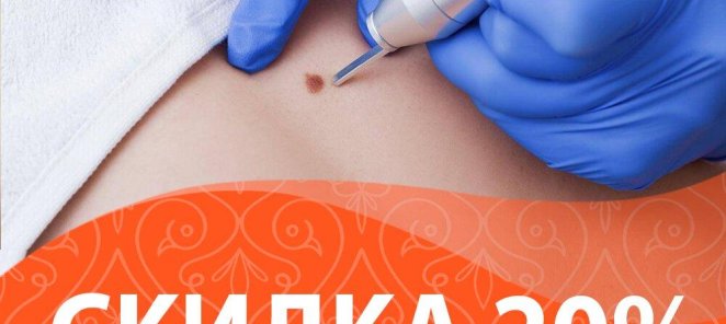 Скидка 20% на лазерное удаление новообразований