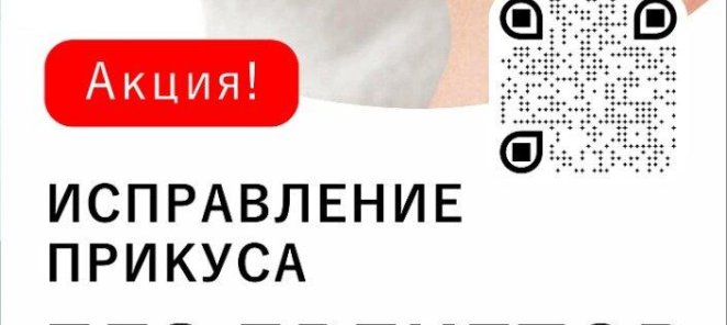 Исправление прикуса без брекетов