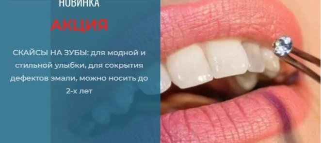 АКЦИЯ! НОВИНКА! Скайсы на зубы