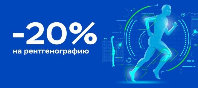 Скидка 20% на рентгенографию