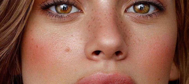 Контурная пластика губ Stylage M 1 ml
