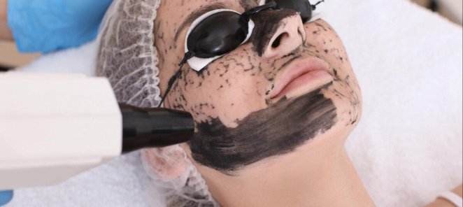 Карбоновый пилинг лица, шеи и рук 2500р