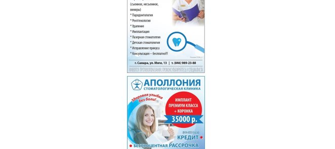 Имплантация зубов от 34000 р!