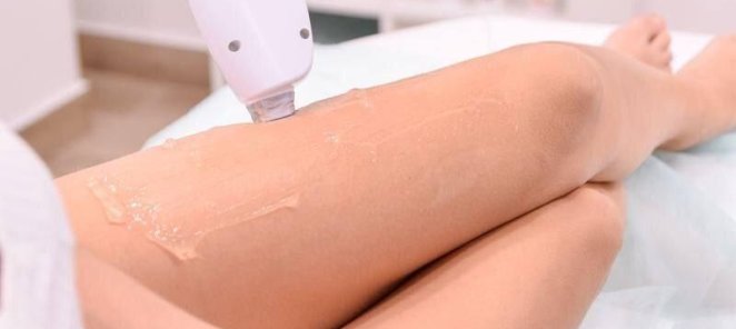 Лазерная эпиляция всего тела 3990 рублей