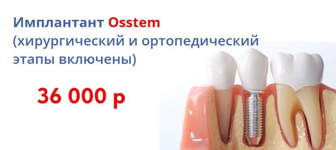 Имплантант Osstem с установкой по спец цене!