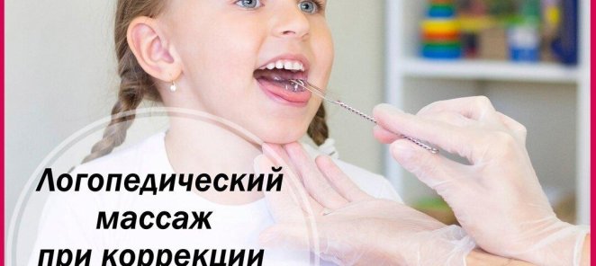 Логопедический массаж