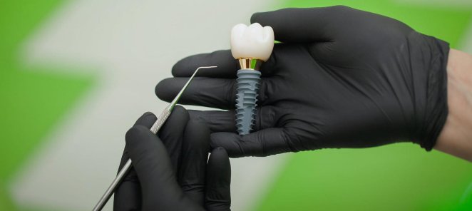 Зубные корейские импланты Dentium со скидкой 50% - за 19900₽