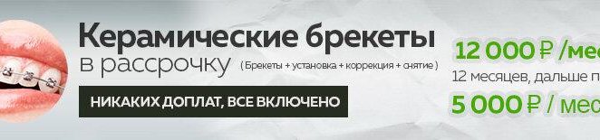 Керамические брекеты в рассрочку 5000 руб/мес*