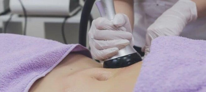 Уз-кавитация + RF лифтинг за 5000 рублей