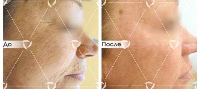При онлайн-записи через сайт - скидка 40%!