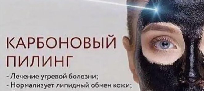 АКЦИЯ! Карбоновый пилинг 4000р вместо 5600р
