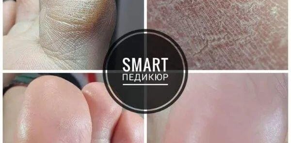 SMART - романтический педикюр