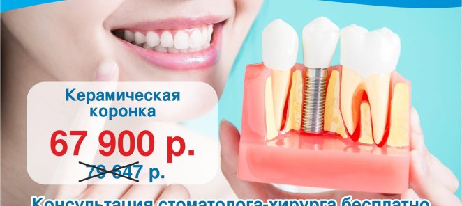 Имплантация зубов «под ключ» за 67 900 руб.