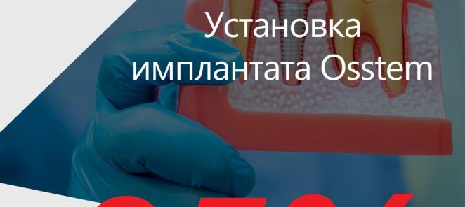 Имплант DIO с установкой по специальной цене 21900