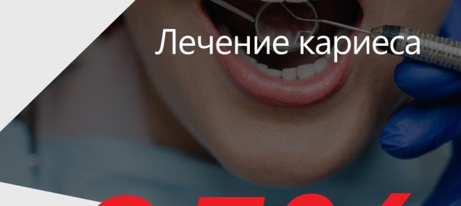 АКЦИЯ! Кариес+пломба всего за 4900 р.!