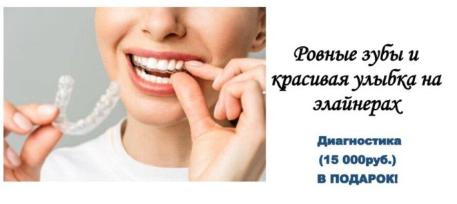 Лечение на элайнерах! Диагностика(15 000) в подарок!