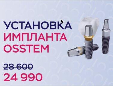 Установка импланта Osstem за 24990 руб.