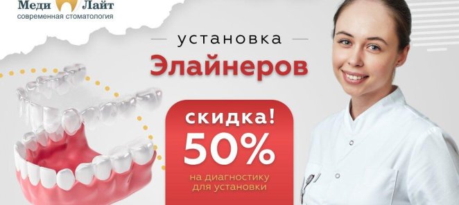 Скидка 50% на диагностику для установки элайнеров.