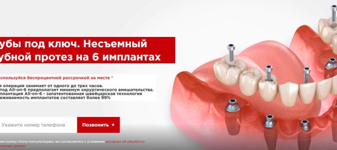Зубы под ключ. Несъемный зубной протез на 6 имплантах