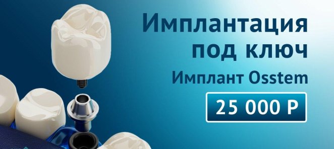 Имплантация под ключ. Имплант Osstem 25 000 руб.