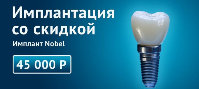 Имплантация со скидкой. Импланты Nobel 45 000руб.