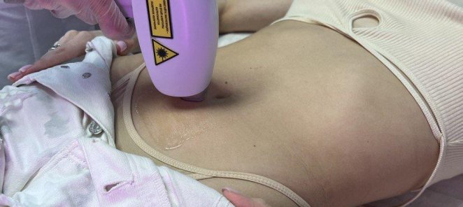 Лазерная эпиляция комплекс 