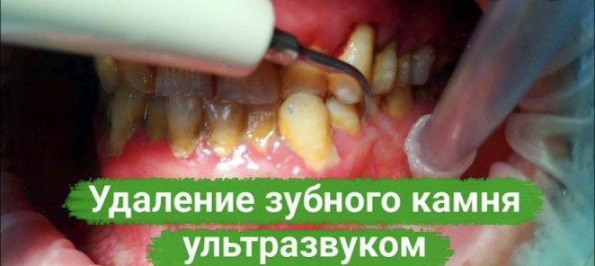 Консультация любого стоматолога-бесплатная