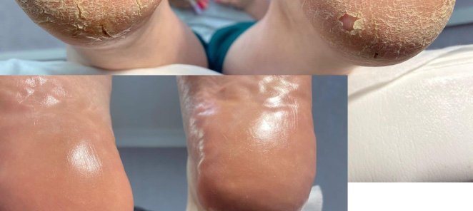 Акция! Smart педикюр Spa комплекс всего 1800 руб вместо 2100