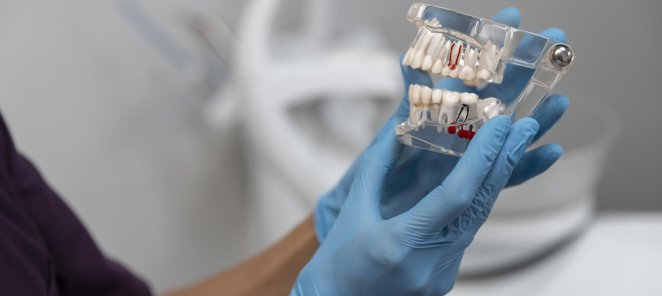 Имплант Osstem и циркониевая коронка всего за 60 000 рублей!