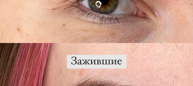Заживляющая уходовая косметика каждому клиенту!