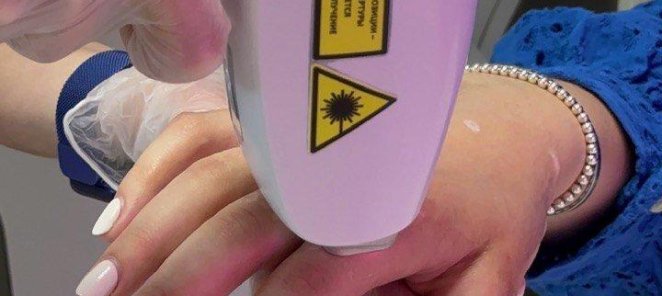 Лазерная эпиляция комплекс 