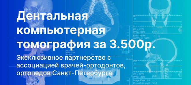 Дентальная КТ