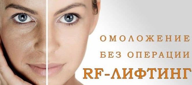 Новинка!!! RF -ЛИФТИНГ со скидкой 20% на первое посещение