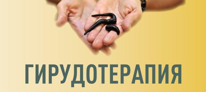 Семинар по Гирудотерапии 6.02.-8.02