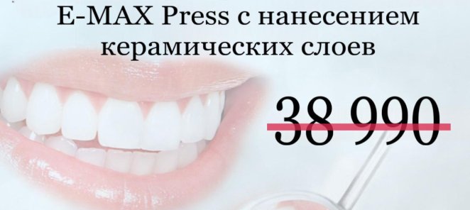 Винир керамический E-MAX