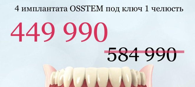 Конструкция с опорой на 4 имплантата из диоксида циркония