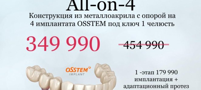 Конструкция с опорой на 4 импланта с адаптационным протезом