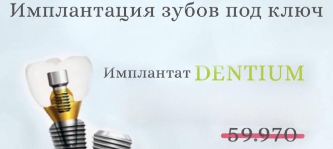Имплантация зубов под ключ DENTIUM