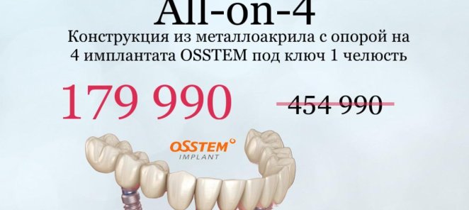 Конструкция с опорой на 4 импланта с адаптационным протезом