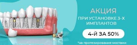 Установи 3 импланта и получи 4-ый по 50% скидке!