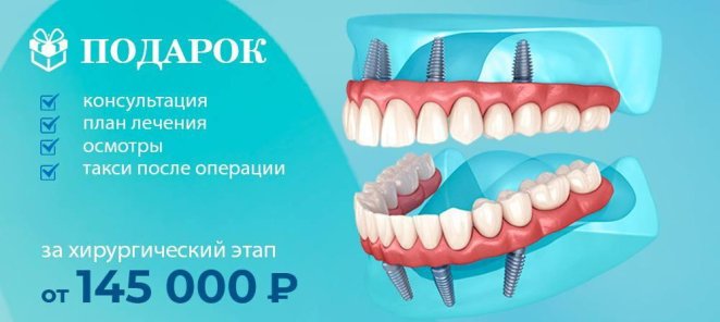Все зубы за 1 день по системе 