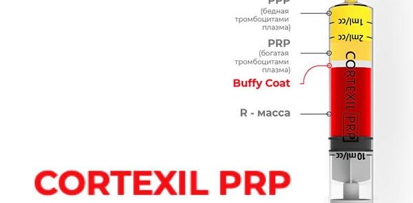 Лечебное PRP суставов по методике Cortexil